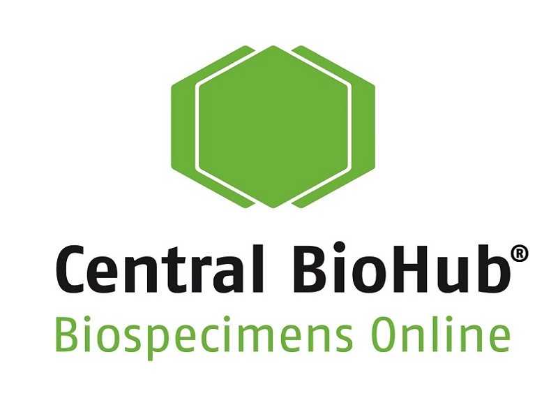 TNBC Samples | Order Biospecimens Online